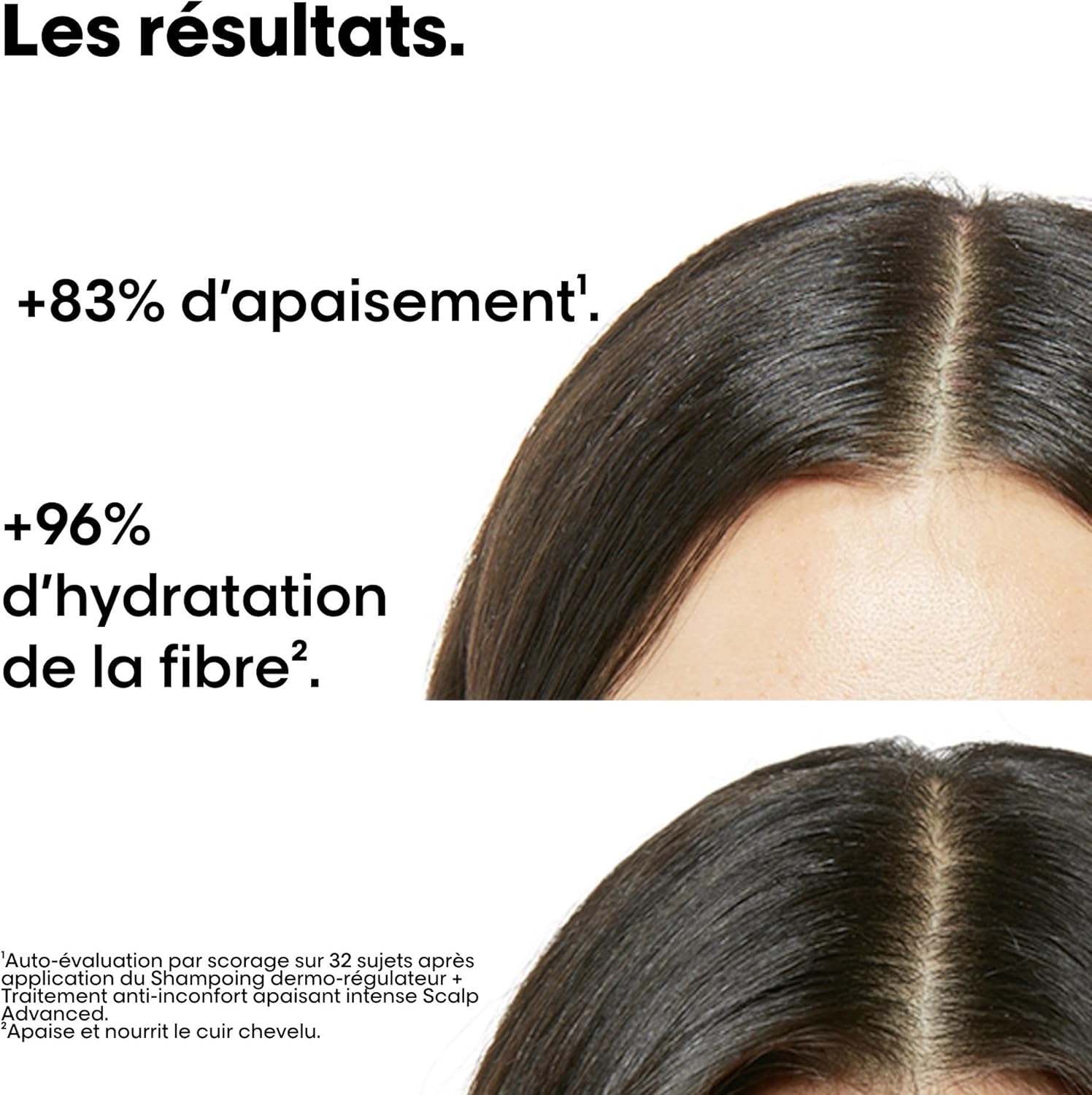 L'Oréal Professionnel - Serie Expert - coffret shampoing + soin - cuir chevelu sensible, anti-démangeaisons