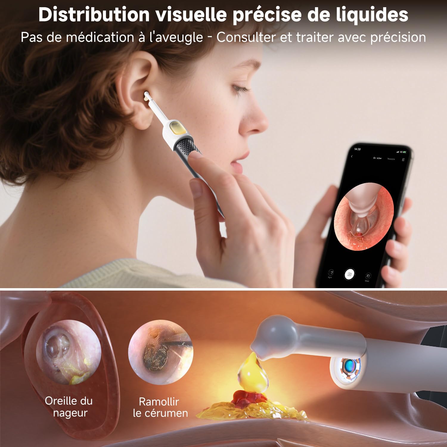 Otoscope - Kit nettoyage oreille caméra lumière USB - nettoyage précis