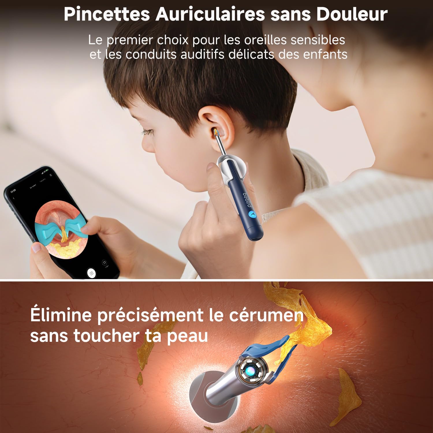 Otoscope - kit nettoyage oreille avec caméra HD, lumière LED, 4 outils